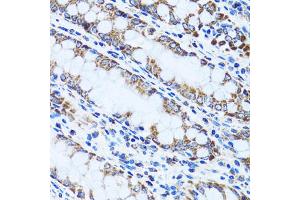Immunohistochemistry of paraffin-embedded human colon using GIP antibody (ABIN1882357) at dilution of 1:100 (40x lens). (GIP Antikörper)