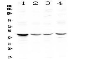 Western blot analysis of Caspase 4 using anti-Caspase 4 antibody .
