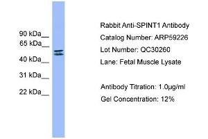 WB Suggested Anti-SPINT1  Antibody Titration: 0. (SPINT1 Antikörper  (C-Term))