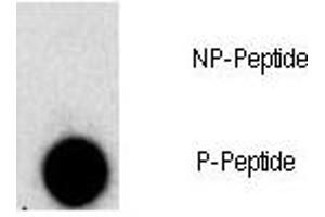 Dot Blot (DB) image for anti-Fibroblast Growth Factor Receptor 1 (FGFR1) (pTyr307) antibody (ABIN3030944)