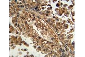 Immunohistochemistry (IHC) image for anti-ATP-Binding Cassette, Sub-Family G (WHITE), Member 1 (ABCG1) (AA 168-195) antibody (ABIN3030058)
