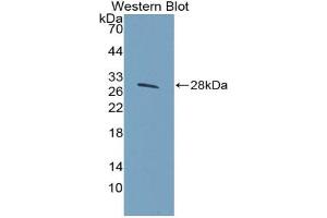 Western blot analysis of the recombinant protein. (HSPG2 Antikörper  (AA 4149-4391))