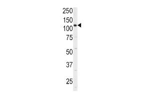 Western Blotting (WB) image for anti-Integrin, alpha 6 (ITGA6) (AA 1043-1072), (Isoform 2) antibody (ABIN389229)