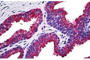 Human Prostate: Formalin-Fixed, Paraffin-Embedded (FFPE) (NPR2 Antikörper  (AA 131-231))