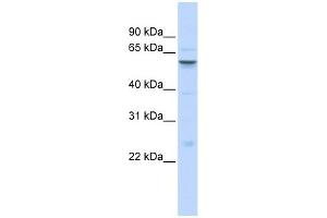 IGFALS antibody used at 1 ug/ml to detect target protein. (IGFALS Antikörper  (Middle Region))