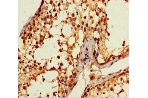 Immunohistochemistry of paraffin-embedded human testis tissue using ABIN7144155 at dilution of 1:100 (ANKDD1A Antikörper  (AA 272-490))