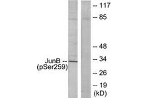 Western blot analysis of extracts from HeLa cells, using JunB (Phospho-Ser259) Antibody. (JunB Antikörper  (pSer259))
