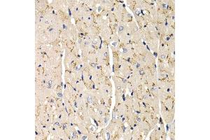Immunohistochemistry of paraffin-embedded mouse heart using SFRP2 antibody (ABIN6131355, ABIN6147675, ABIN6147677 and ABIN6221030) at dilution of 1:200 (40x lens). (SFRP2 Antikörper  (AA 25-295))