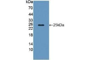 Detection of Recombinant CAPS, Human using Polyclonal Antibody to Calcyphosine (CAPS) (Calcyphosine Antikörper  (AA 1-189))
