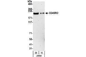 Western Blotting (WB) image for anti-CD45RO (CD45RO) antibody (ABIN7449553) (CD45RO Antikörper)