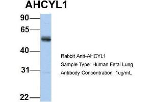 Host: Rabbit Target Name: AHCYL1 Sample Type: Human Fetal Lung Antibody Dilution: 1. (AHCYL1 Antikörper  (N-Term))
