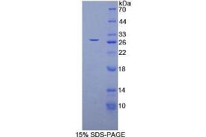 SDS-PAGE (SDS) image for Glutathione S-Transferase mu 4 (GSTM4) (AA 18-215) protein (His tag) (ABIN1878565)
