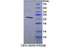 SDS-PAGE (SDS) image for Fast Skeletal Troponin I (TNNI2) (AA 1-182) protein (His tag) (ABIN1879001)