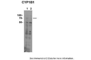 Sample type: 1. (CYP11B1 Antikörper  (C-Term))