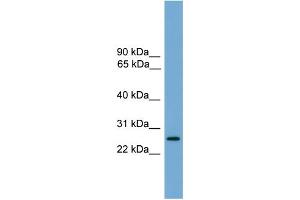 WB Suggested Anti-LRRC3 Antibody Titration:  0. (LRRC3 Antikörper  (Middle Region))