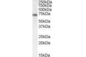 Western Blotting (WB) image for anti-Netrin 1 (NTN1) (C-Term) antibody (ABIN2464806) (Netrin 1 Antikörper  (C-Term))