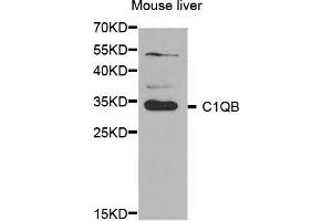 Western Blotting (WB) image for anti-Complement Component 1, Q Subcomponent, B Chain (C1QB) antibody (ABIN1876527)