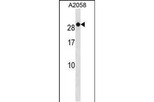 Western blot analysis in A2058 cell line lysates (35ug/lane). (RAB7B Antikörper  (C-Term))