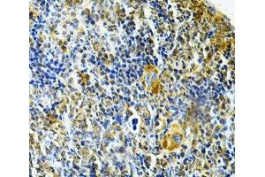 Immunohistochemistry (Paraffin-embedded Sections) (IHC (p)) image for anti-Glutaredoxin 1 (GRX1) antibody (ABIN7261263)