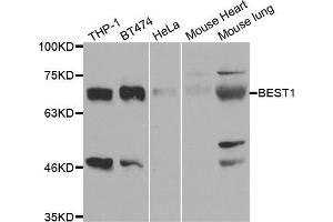 Western blot analysis of extracts of various cell lines, using BEST1 antibody (ABIN5973362) at 1/1000 dilution. (Bestrophin 1 Antikörper)