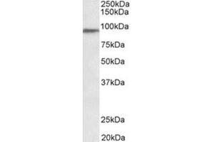 AP31936PU-N PTCHD3 antibody staining of Human Testis lysate at 0. (PTCHD3 Antikörper  (Internal Region))