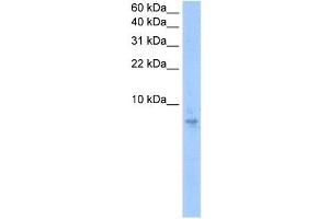 Septin 6 antibody used at 0. (Septin 6 Antikörper  (N-Term))
