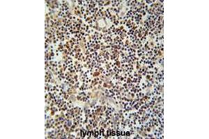 CLM1 Antibody (N-term) immunohistochemistry analysis in formalin fixed and paraffin embedded human lymph tissue followed by peroxidase conjugation of the secondary antibody and DAB staining. (IREM1 Antikörper  (N-Term))