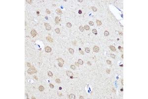 Immunohistochemistry of paraffin-embedded Rat brain using CNOT7 Rabbit pAb (ABIN6127563, ABIN6138783, ABIN6138784 and ABIN6224834) at dilution of 1:50 (40x lens). (CNOT7 Antikörper  (AA 90-160))