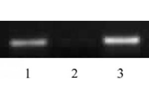 Histone H4 acetyl Lys5 antibody tested by ChIP.