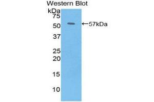 Western Blotting (WB) image for anti-PDGF-BB Homodimer (AA 5-225) antibody (ABIN1860156) (PDGF-BB Homodimer (AA 5-225) Antikörper)