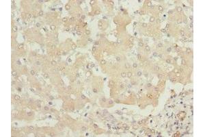 Immunohistochemistry (IHC) image for anti-Phosphorylase Kinase, beta (PHKB) (AA 854-1093), (Regulatory Subunit beta) antibody (ABIN7163408)