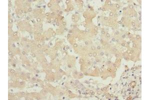 Immunohistochemistry of paraffin-embedded human liver tissue using ABIN7163408 at dilution of 1:100 (PHKB Antikörper  (Regulatory Subunit beta))