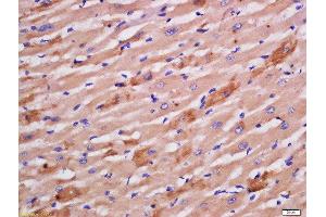 Formalin-fixed and paraffin embedded rat heart labeled with Rabbit Anti-Sarcomeric Alpha Actinin Polyclonal Antibody, Unconjugated  at 1:200 followed by conjugation to the secondary antibody and DAB staining (ACTN2 Antikörper  (AA 351-450))