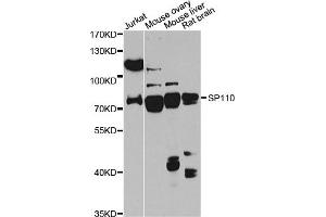 Western blot analysis of extracts of various cell lines, using SP110 antibody (ABIN6290941) at 1:1000 dilution. (SP110 Antikörper)