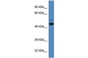 Image no. 1 for anti-SPRY Domain Containing 3 (SPRYD3) (AA 98-147) antibody (ABIN6746883) (SPRYD3 Antikörper  (AA 98-147))