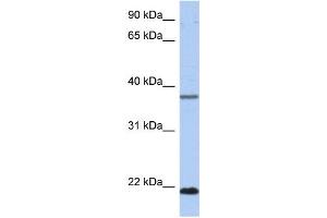 WB Suggested Anti-HDDC3 Antibody Titration: 0. (HDDC3 Antikörper  (Middle Region))
