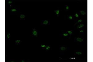 Immunofluorescence of monoclonal antibody to MEOX1 on HeLa cell. (MEOX1 Antikörper  (AA 82-170))