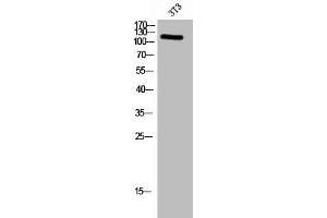 Western Blot analysis of 3T3 cells using Phospho-FAK (Y576) Polyclonal Antibody (FAK Antikörper  (pTyr576))