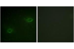 Immunofluorescence analysis of HeLa cells, using Syndecan4 (Ab-179) Antibody. (SDC4 Antikörper  (AA 145-194))
