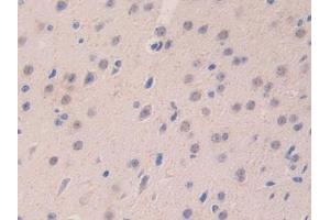 Detection of LAMa4 in Mouse Cerebrum Tissue using Polyclonal Antibody to Laminin Alpha 4 (LAMa4) (LAMa4 Antikörper  (AA 745-940))