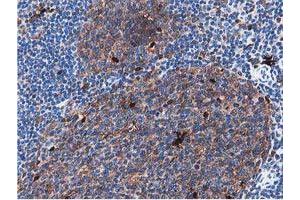 Image no. 8 for anti-Sequestosome 1 (SQSTM1) antibody (ABIN1499988) (SQSTM1 Antikörper)