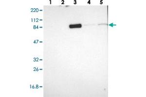 Western blot analysis of Lane 1: RT-4, Lane 2: U-251 MG, Lane 3: Human Plasma, Lane 4: Liver, Lane 5: Tonsil with MTIF2 polyclonal antibody  at 1:250-1:500 dilution. (MTIF2 Antikörper)