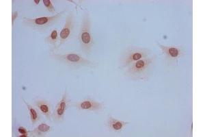 Immunocytochemistry analysis of Hela cells using ABIN7139185 at dilution of 1:100 (HIST1H2BB Antikörper  (acLys5))