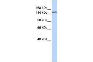 WB Suggested Anti-DGKH Antibody Titration:  0.