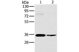 Western Blot analysis of 293T and skov3 cell using OTUB1 Polyclonal Antibody at dilution of 1:570 (OTUB1 Antikörper)
