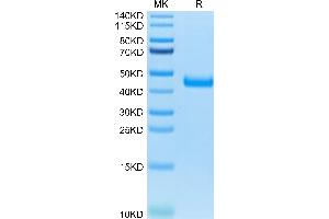 IL17 Receptor B Protein (AA 18-286) (His tag)