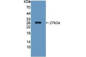Detection of Recombinant SNAP25 using Polyclonal Antibody to Synaptosomal Associated Protein 25 kDa (SNAP25) (SNAP25 Antikörper)