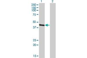 Western Blot analysis of MAGEA4 expression in transfected 293T cell line by MAGEA4 polyclonal antibody (A01). (MAGEA4 Antikörper  (AA 98-171))