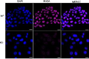Immunocytochemical staining of HT- cells using RHOA antibody (ABIN7800142), 1:1,000), Top panel: wild-type (WT), Bottom panal: RHOA shRNA knockdown (KD). (Rekombinanter RHOA Antikörper)