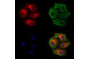 ABIN6256297 and ABIN6267410 staining Hela cells(4h of LPS treatment) by IF/ICC. (Connexin 43/GJA1 Antikörper  (pSer368))